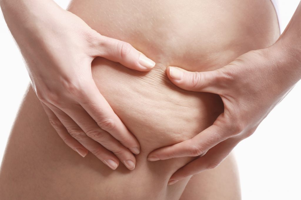 Mesoterapia